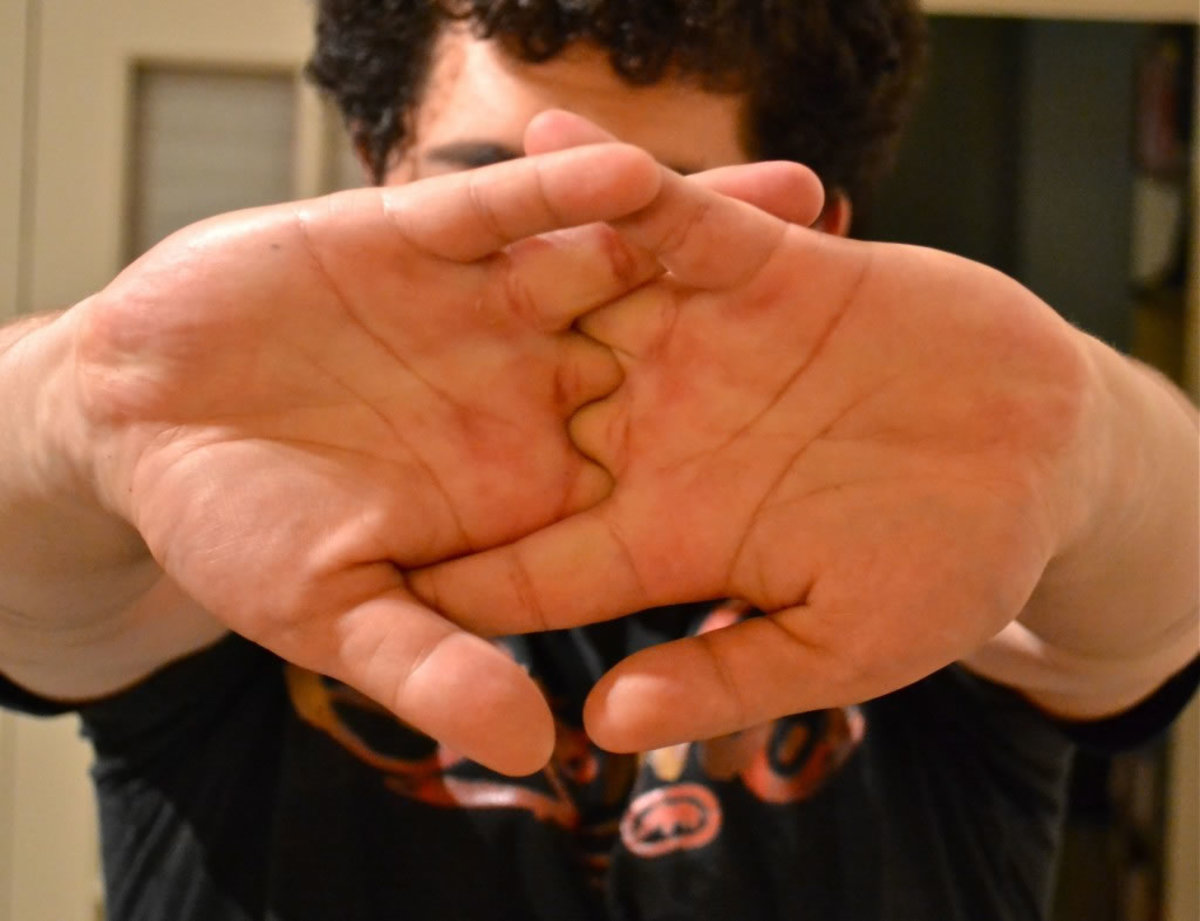 Хруст пальцев. Мужская рука. Щелканье суставами. Хруст пальцев. Хруст пальцев.