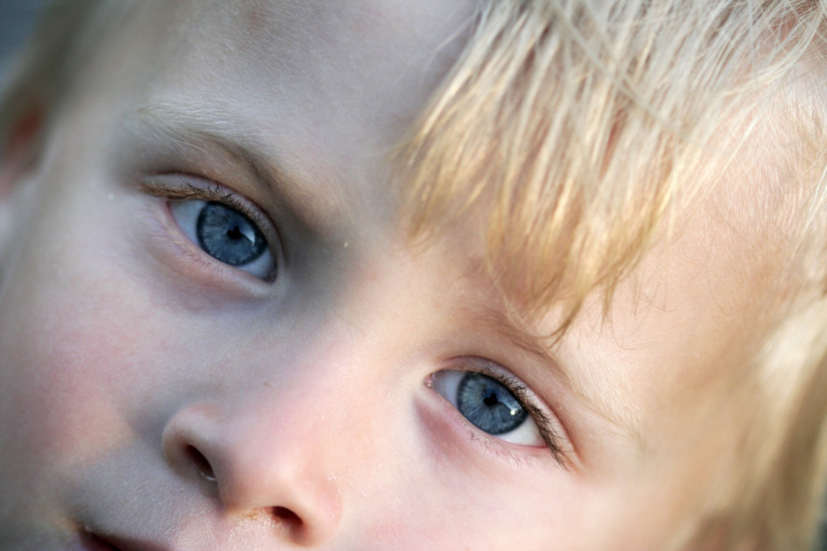 Ребенок косит глазки. Детские глаза. Взгляд ребенка. Глаза мальчика. Косоглазие у детей.