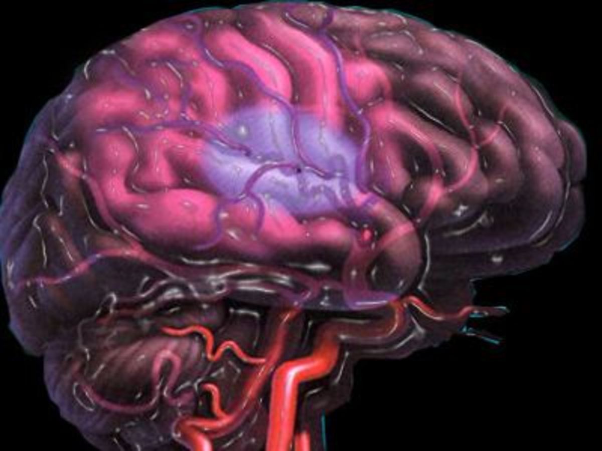 Ишемия мозга последствия у взрослых. Нарушение мозгового кровообращения инсульт. Ишемические нарушения мозгового кровообращения. Сосудистая патология головного мозга. ОНМК мозг.