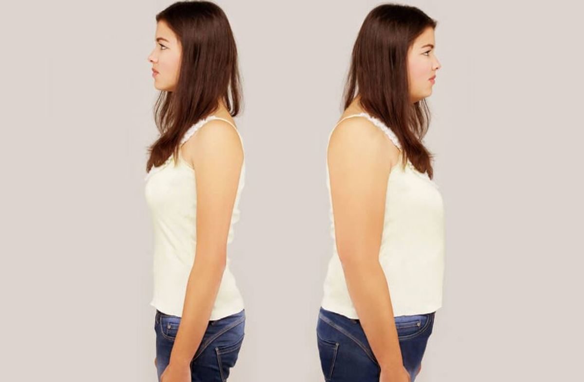 ορμονική ανισορροπία