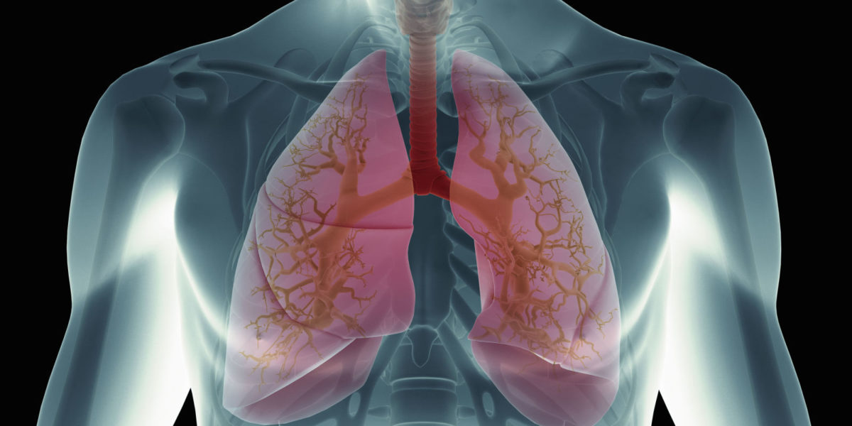 πνευμονικό οίδημα