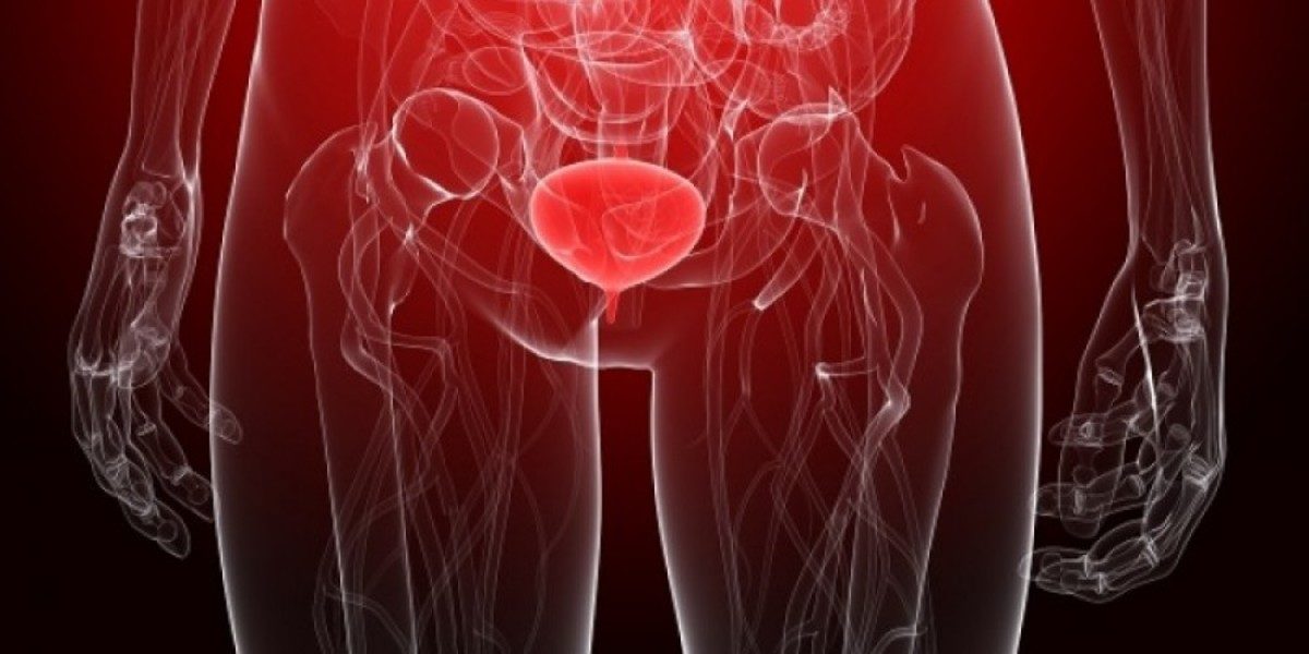 ουρολοίμωξη