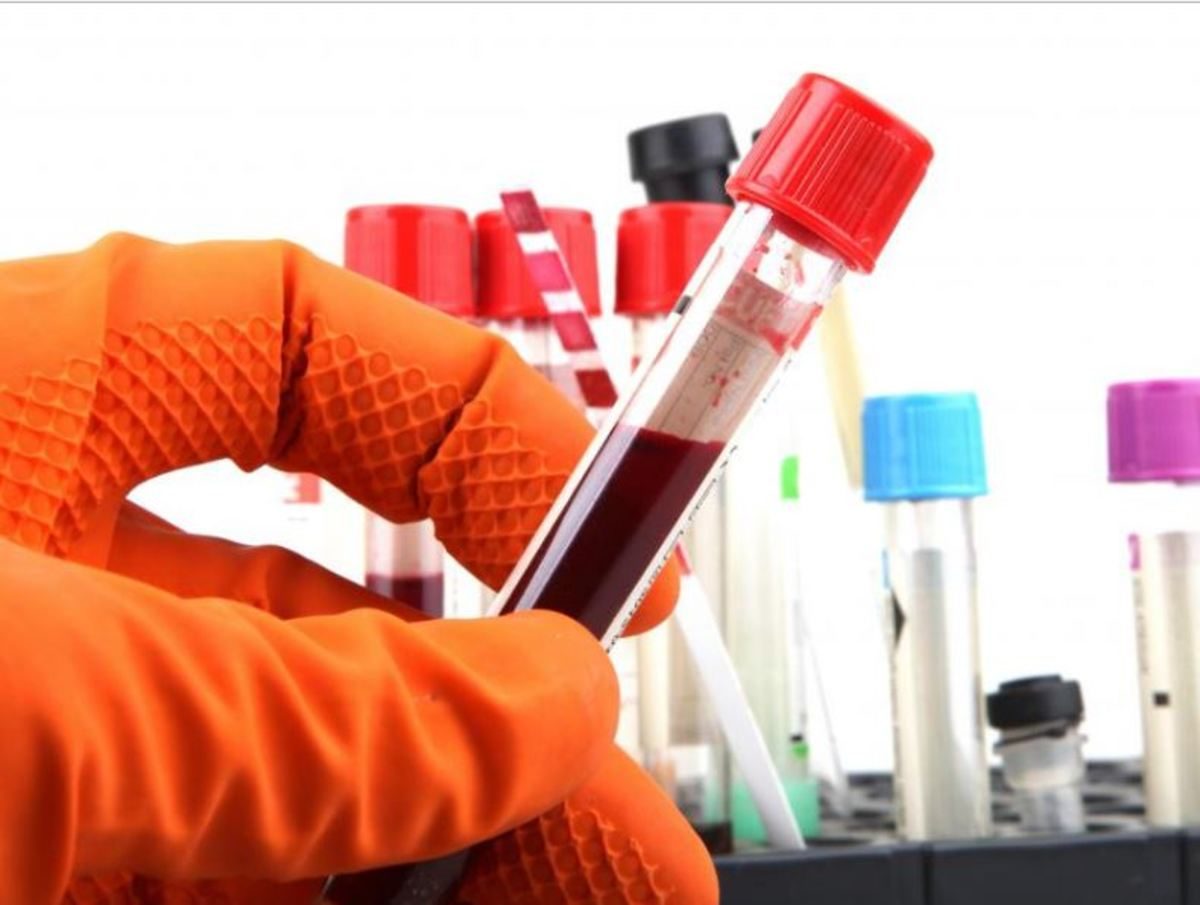 αιματοκρίτης