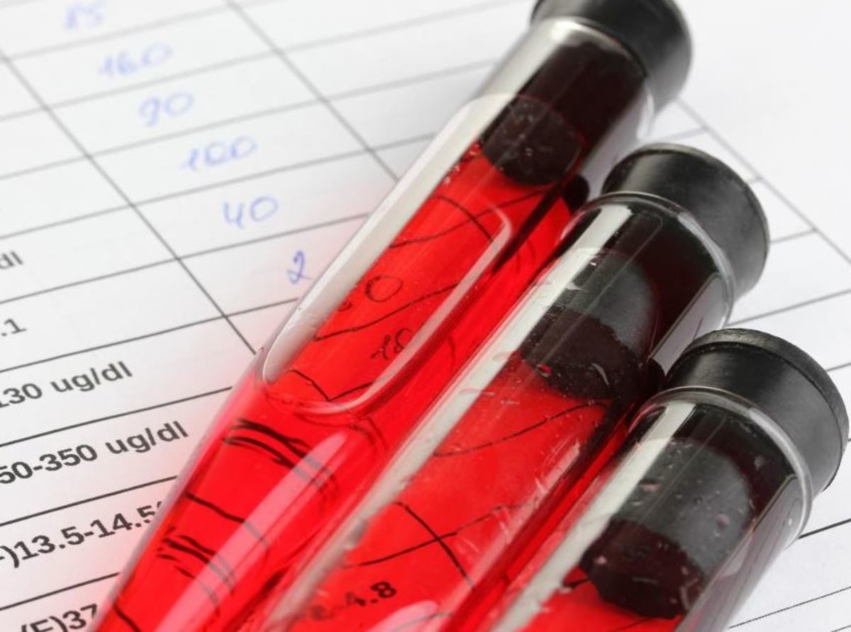 αιματοκρίτης