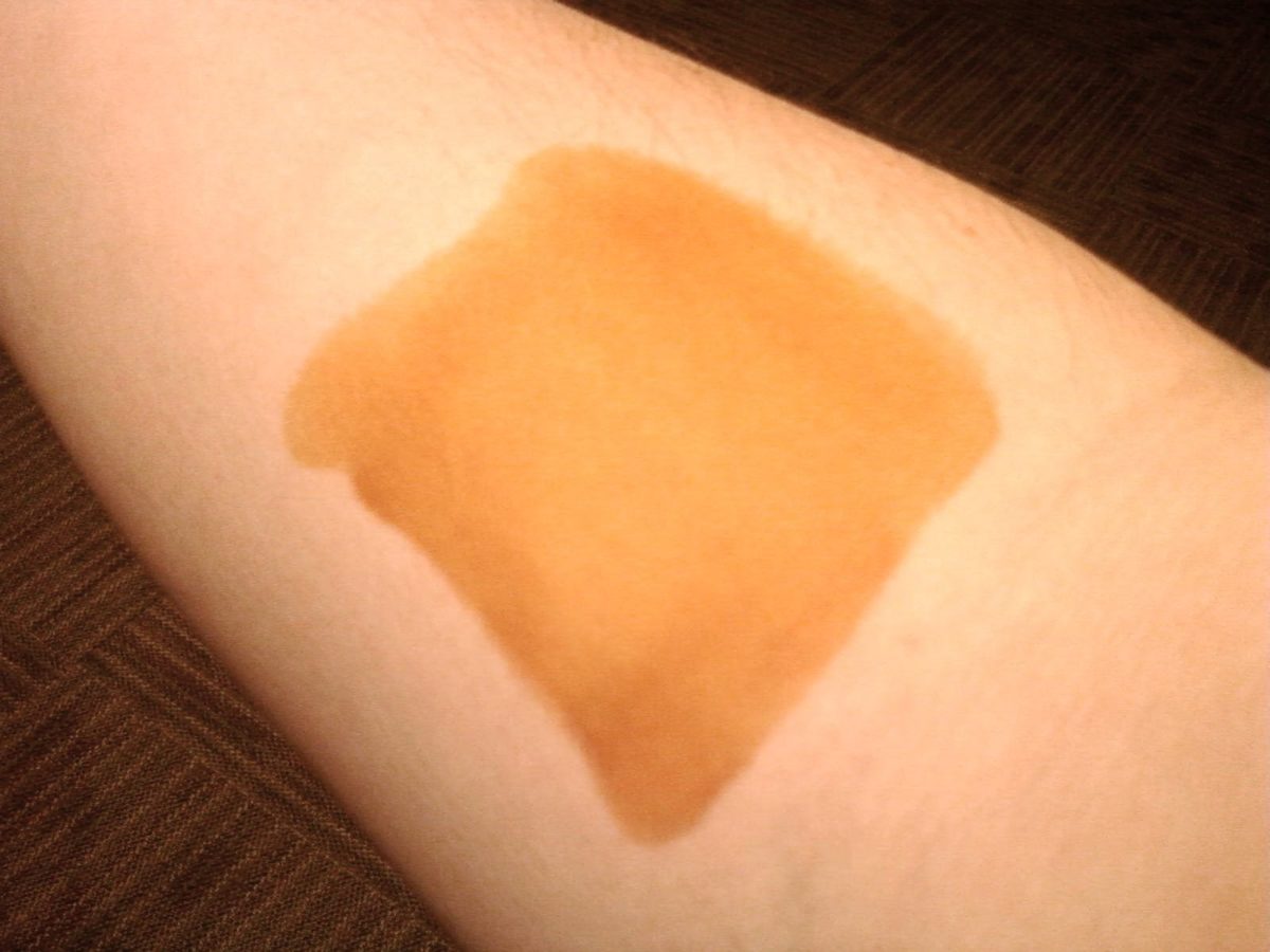 θυρεοειδής