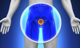 καρκίνος του προστάτη