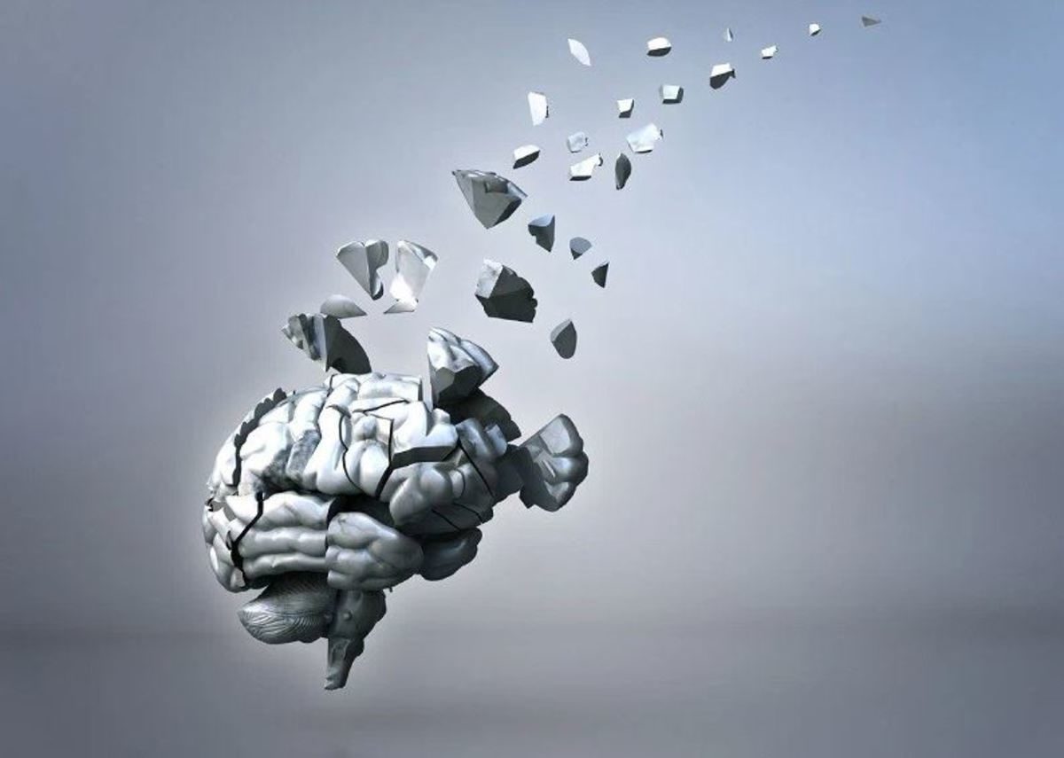 Αλτσχάιμερ