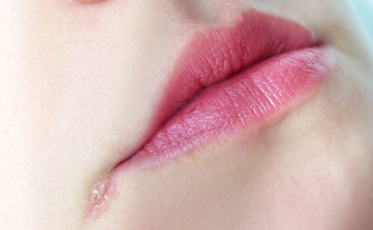 χείλη που σκάνε