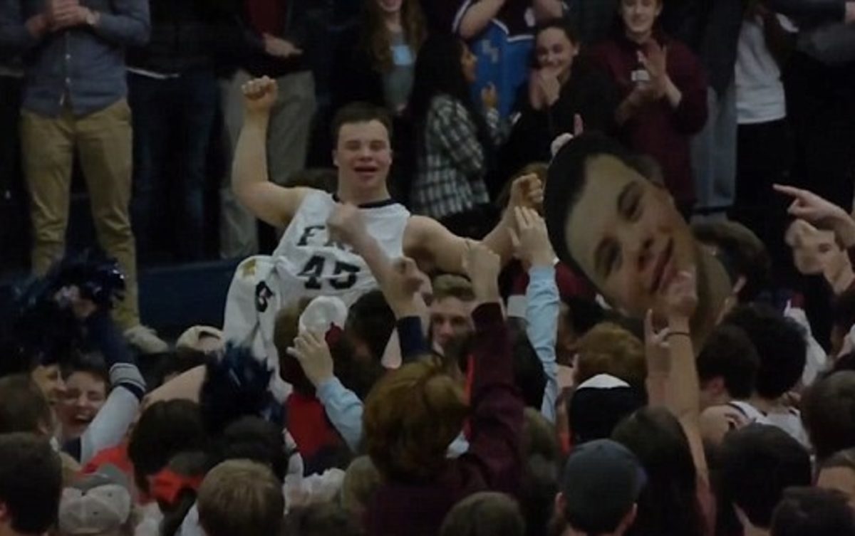 σύνδρομο down