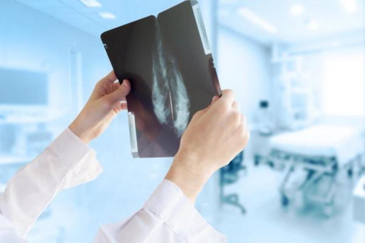 καρκίνος του μαστού