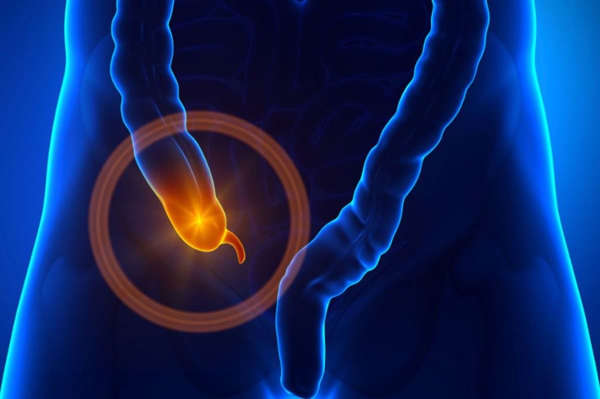 σκωληκοειδίτιδα