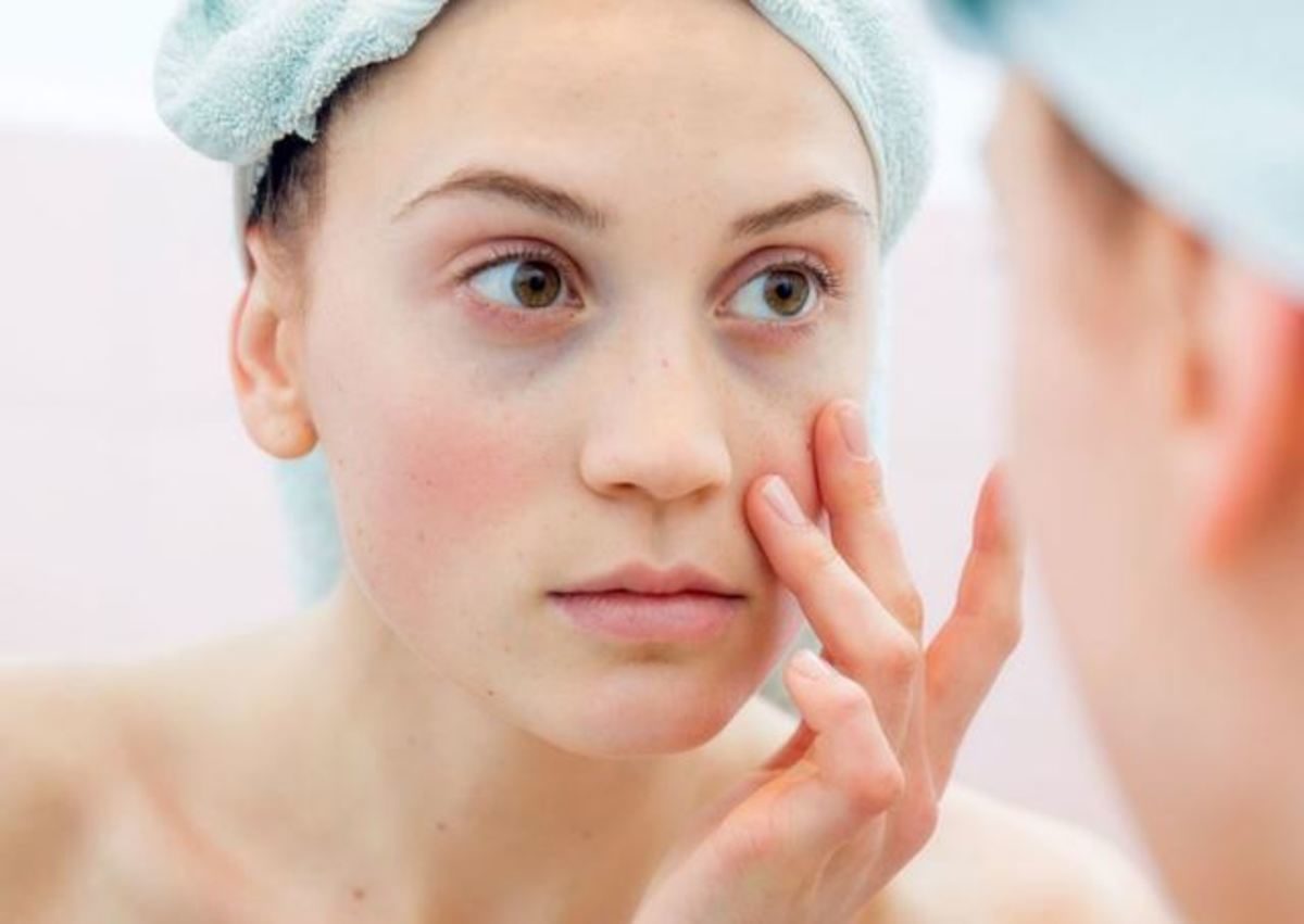 σακούλες στα μάτια