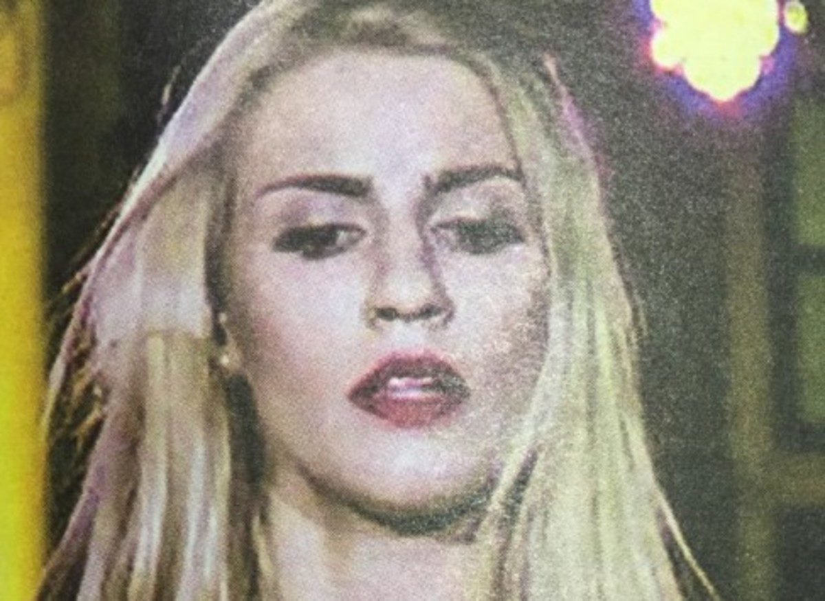 ηλεκτροπληξία