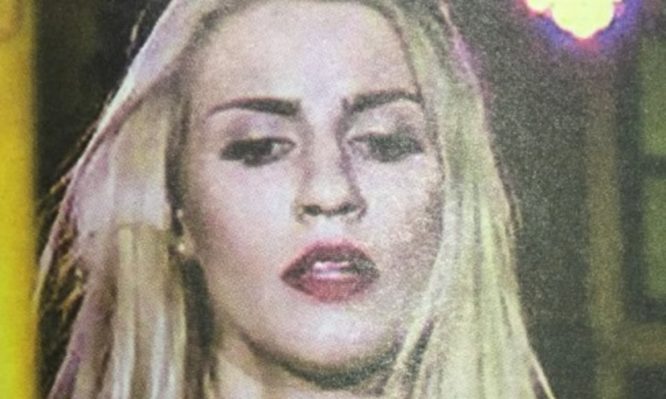 ηλεκτροπληξία