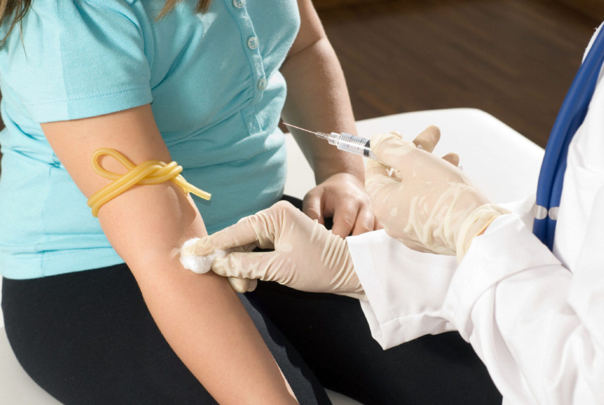 χοληστερίνη