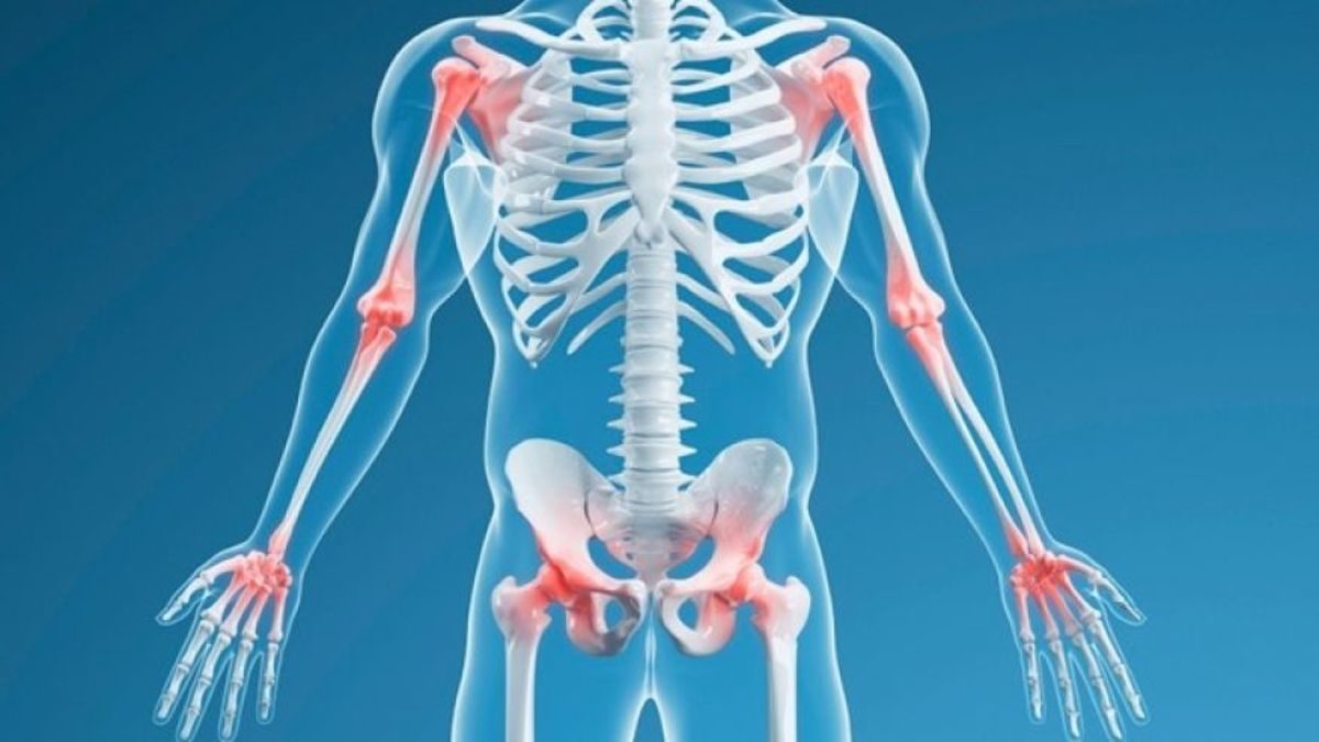 μεταμόσχευση