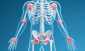 μεταμόσχευση