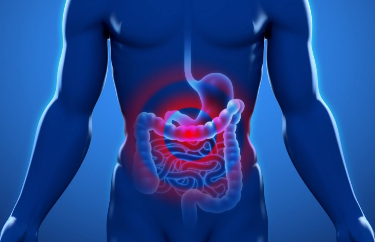 καρκίνος του παχέος εντέρου