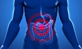 καρκίνος του παχέος εντέρου