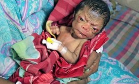 νεογέννητο