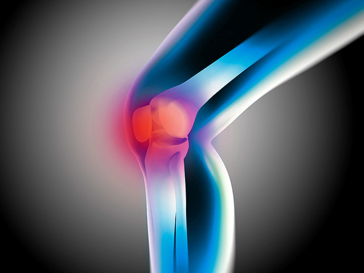 Οστεοαρθρίτιδα