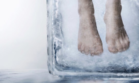 κρυογονική