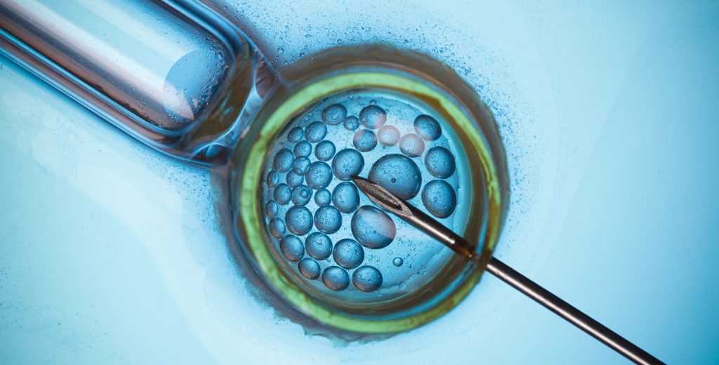 εξωσωματική