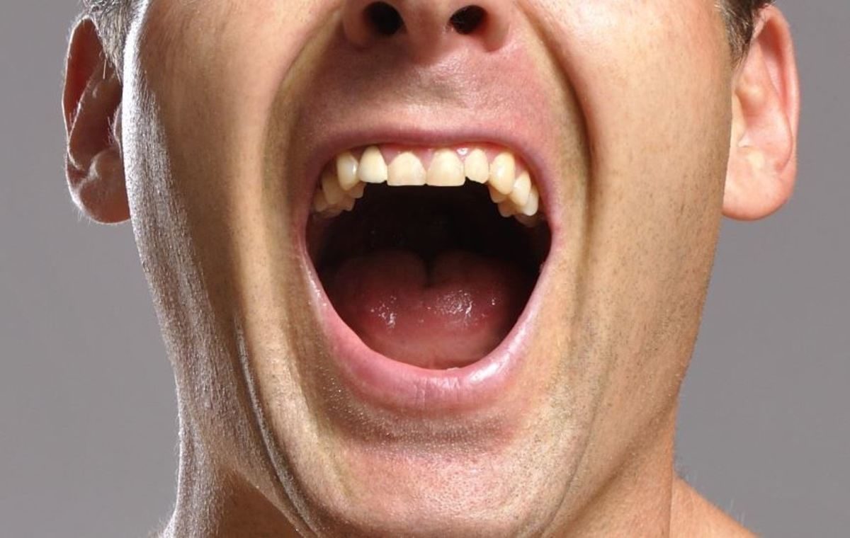 καρκίνος του στόματος