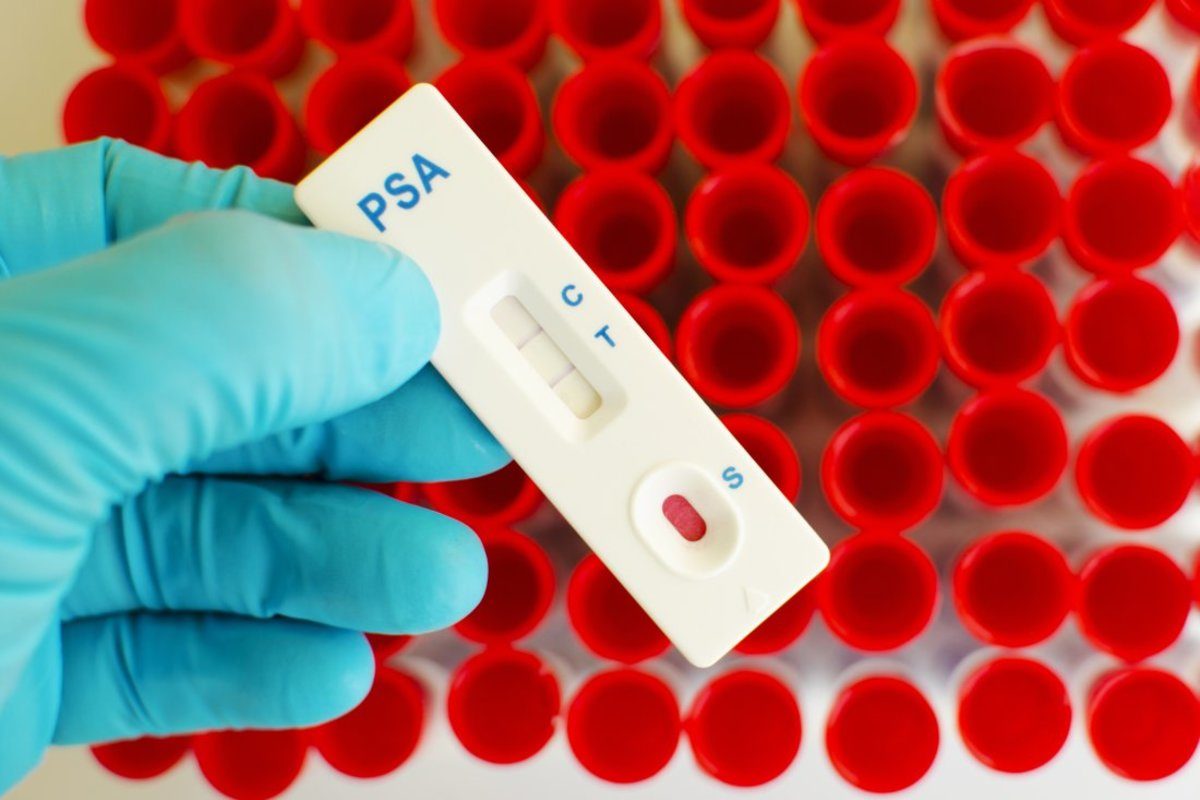 προστατικό αντιγόνο