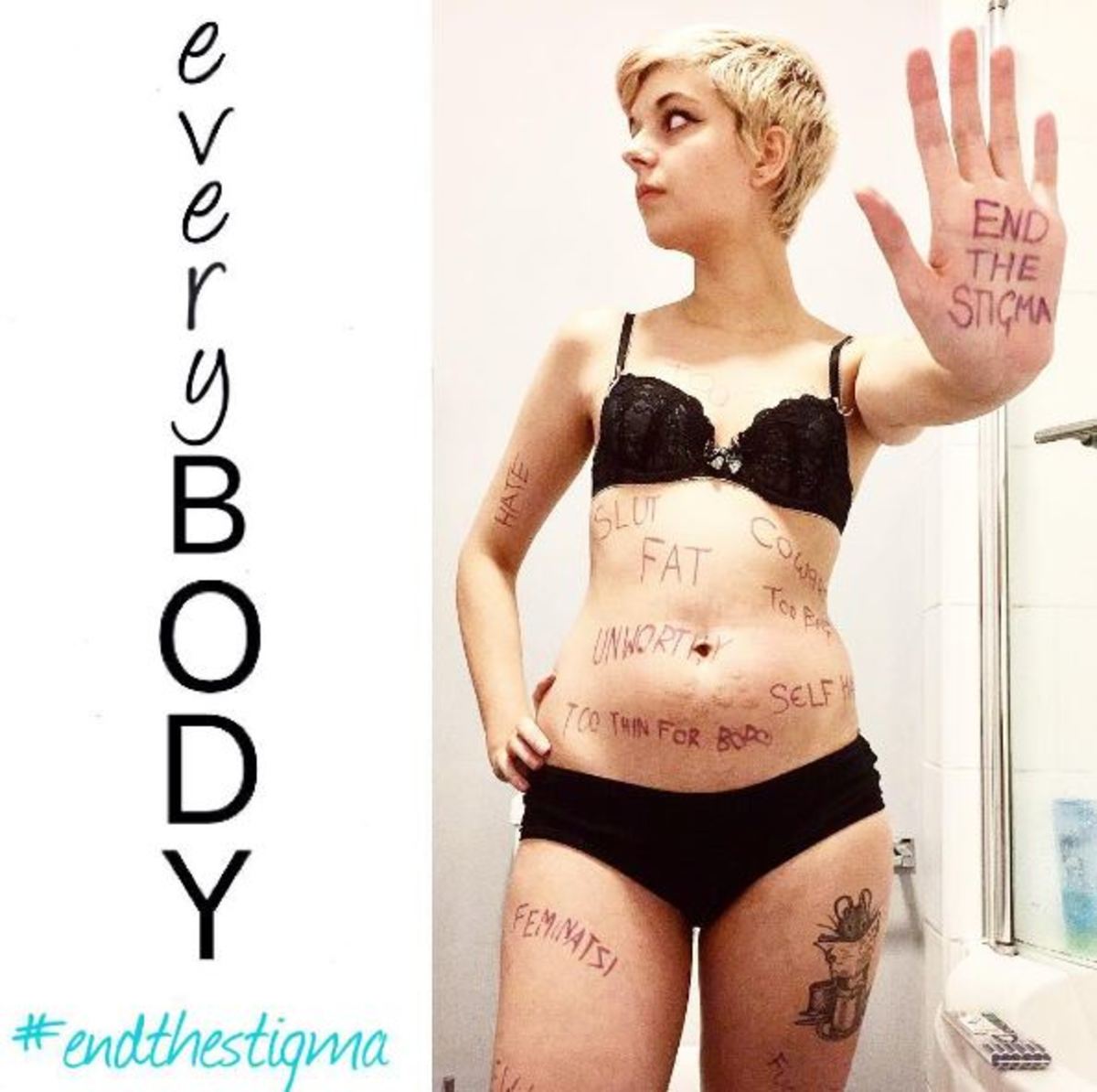 νευρική ανορεξία