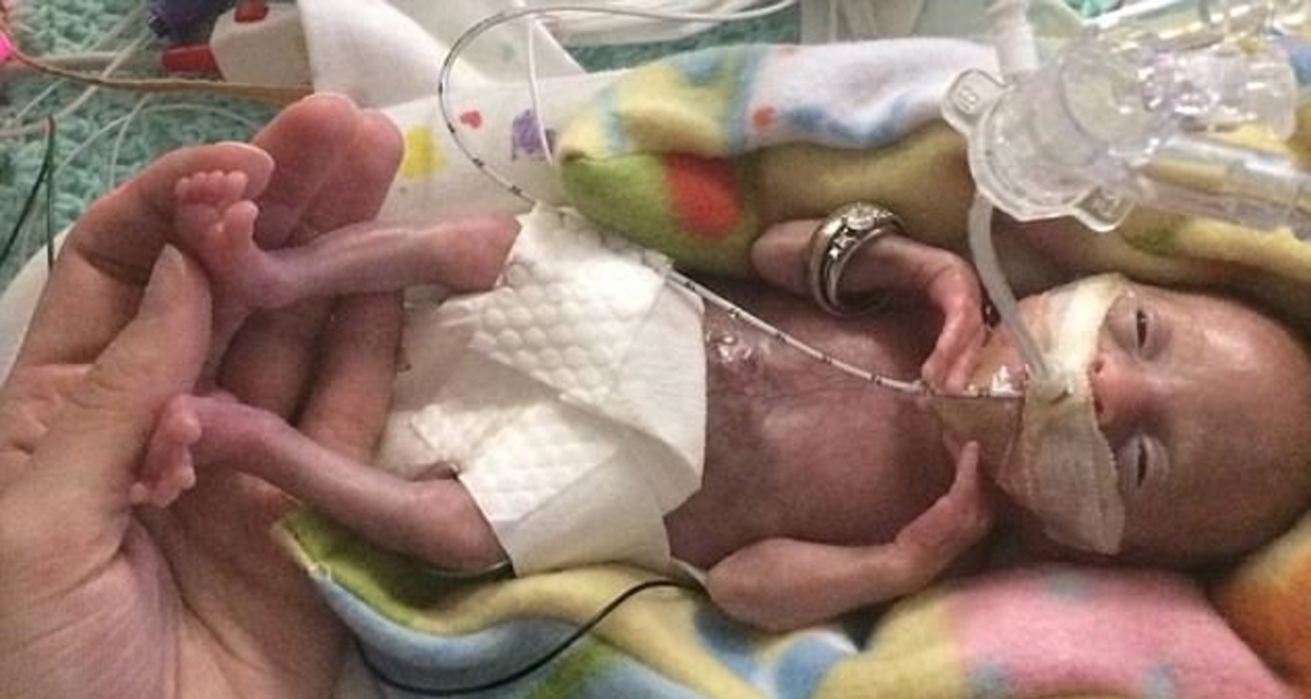 πρόωρο βρέφος