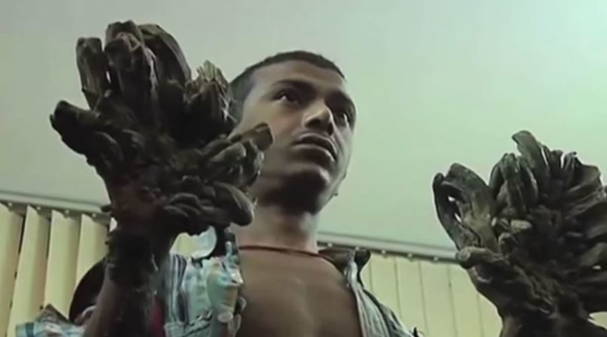 άνθρωπος δέντρο