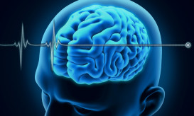 εγκεφαλικά νεκρός