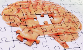 Αλτσχάιμερ