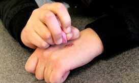 πρόκληση της γόμας