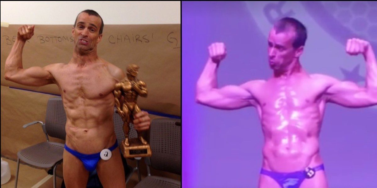 εγκεφαλική παράλυση