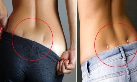 λακκουβάκια της Αφροδίτης