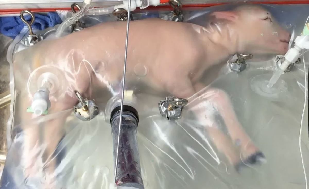 τεχνητή μήτρα