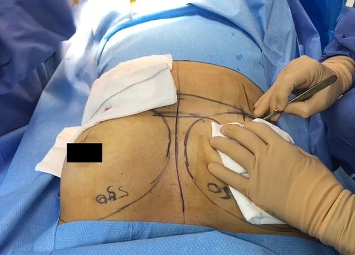 πλαστικός χειρουργός