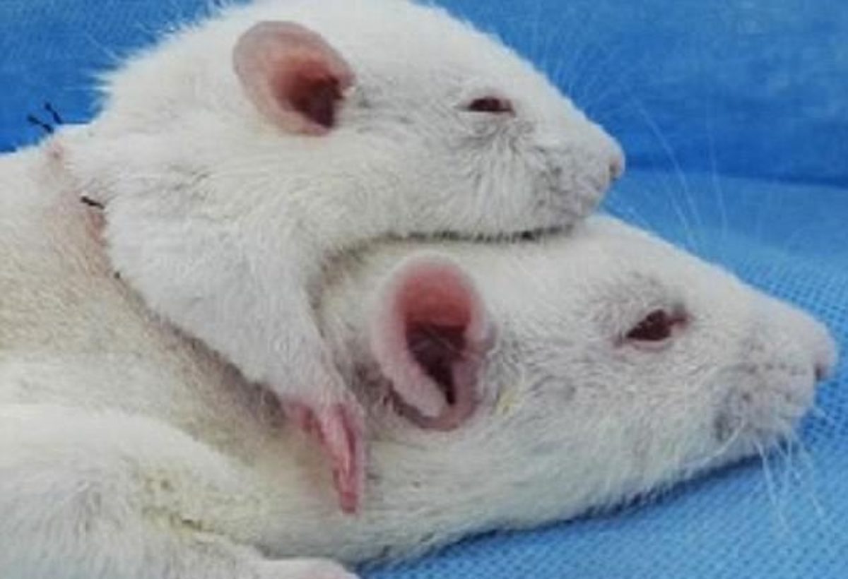 μεταμόσχευση κεφαλιού