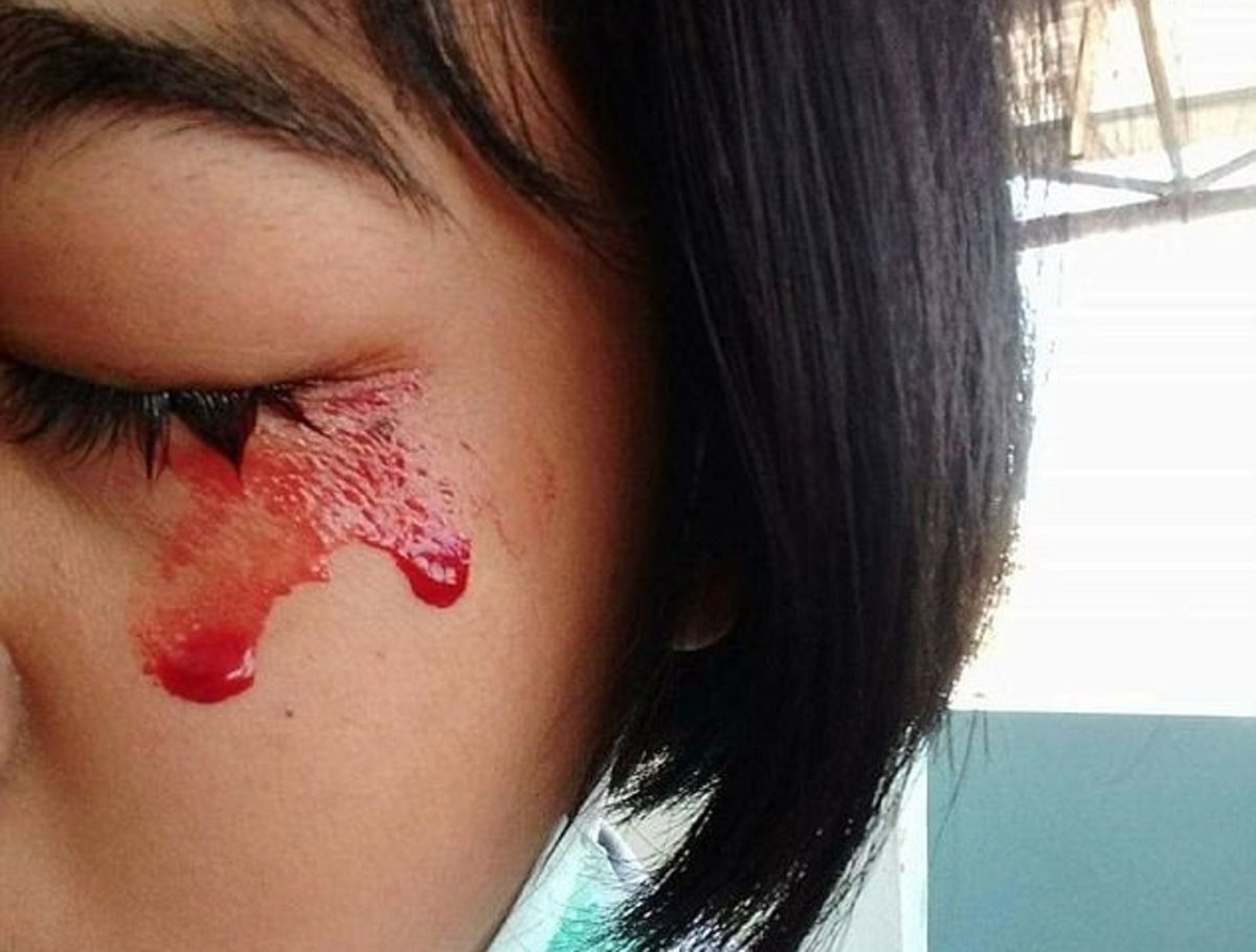 αιματοΐδρωση