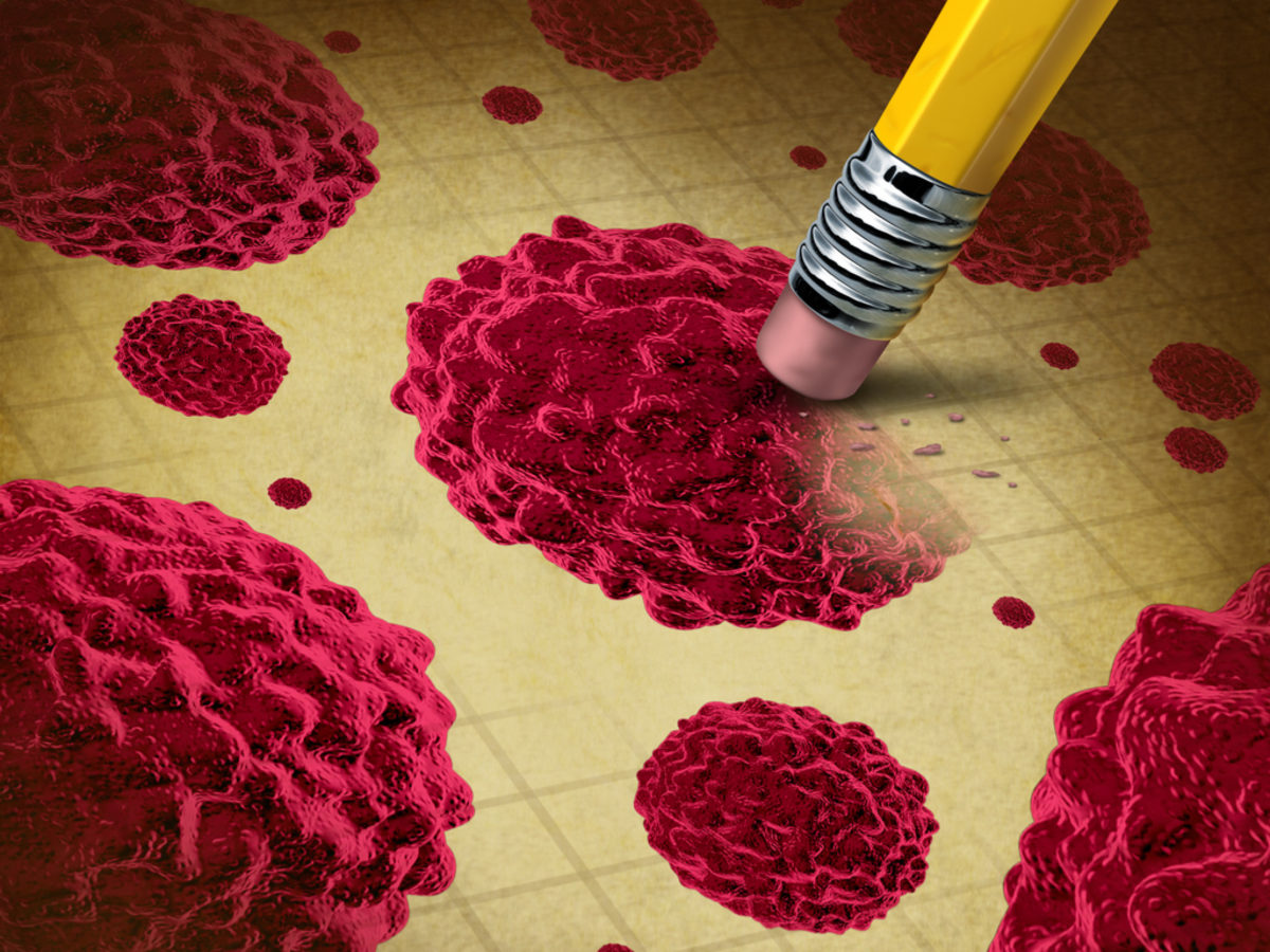 Καρκίνος του προστάτη