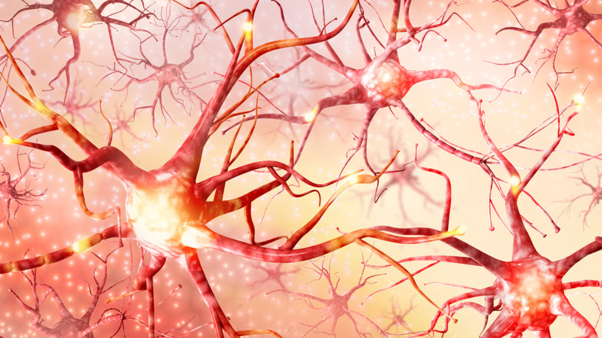 Αλτσχάιμερ