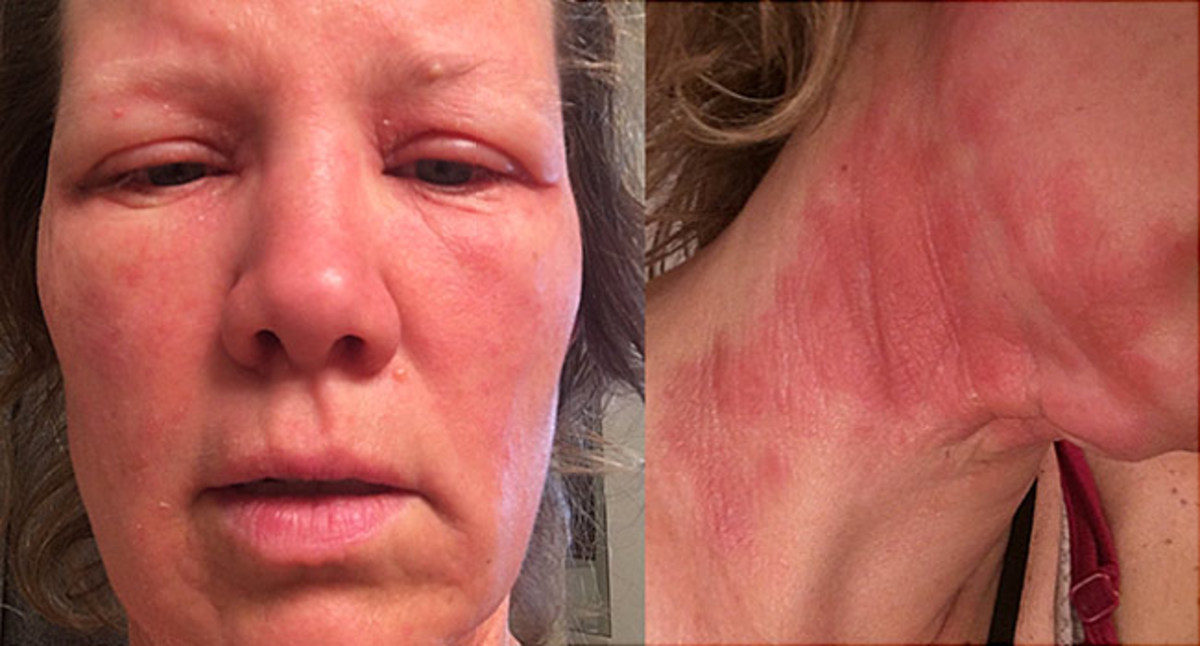 αιθέρια έλαια