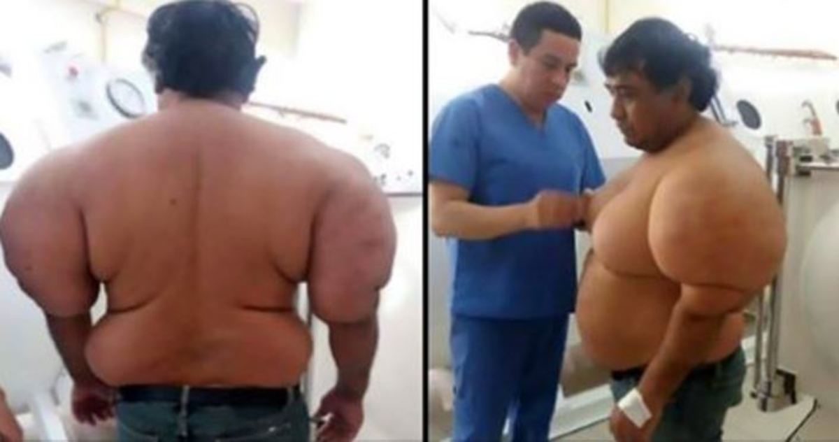 νόσος των δυτών