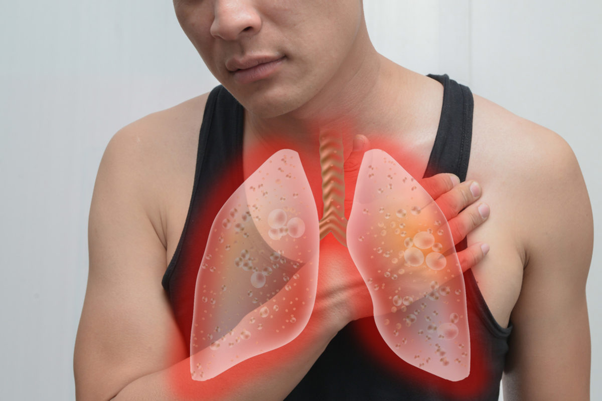 καρκίνος του πνεύμονα