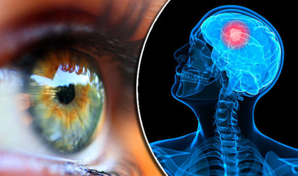 Brain eyes. Нейроофтальмология. 1. Нейроофтальмология. Мозг глаз фото картинки. Существует ли Neuro Glass.