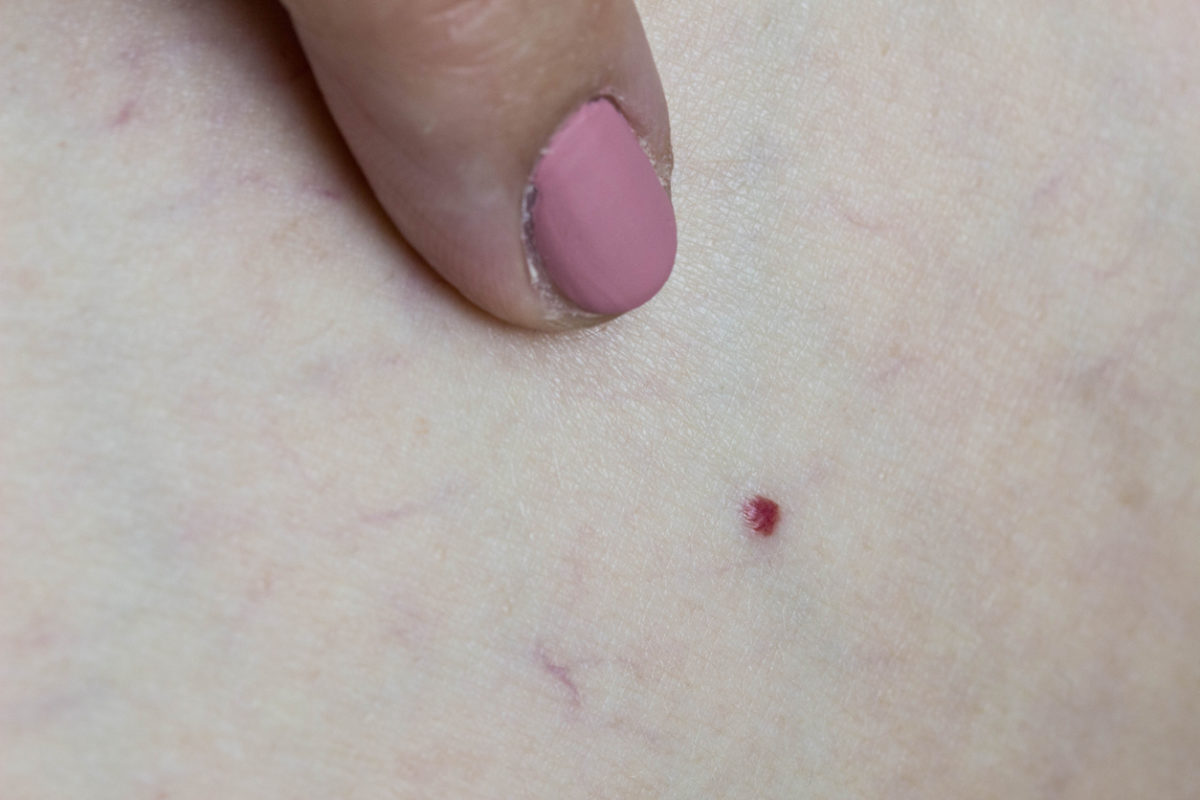 κόκκινες ελιές