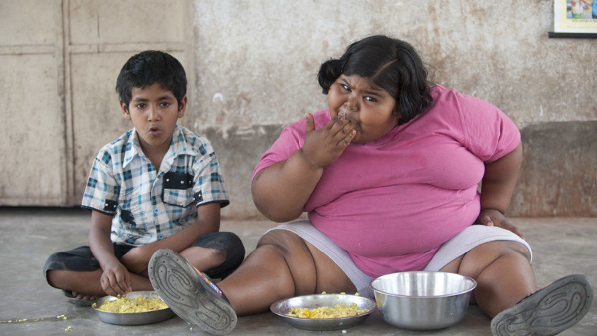 παχυσαρκία