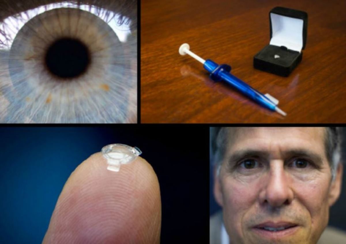 βιονικός φακός